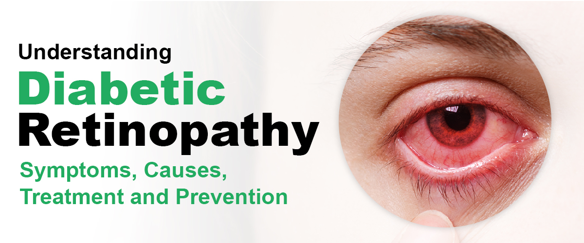 Understanding Diabetic Retinopathy: Symptoms, Causes, Treatment and Prevention