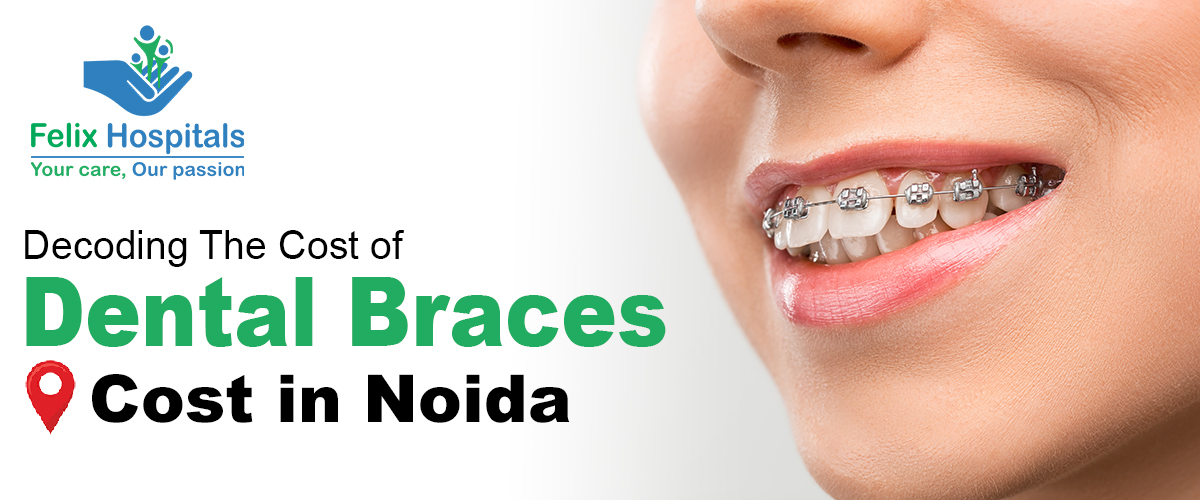 How much do braces cost in 2024?