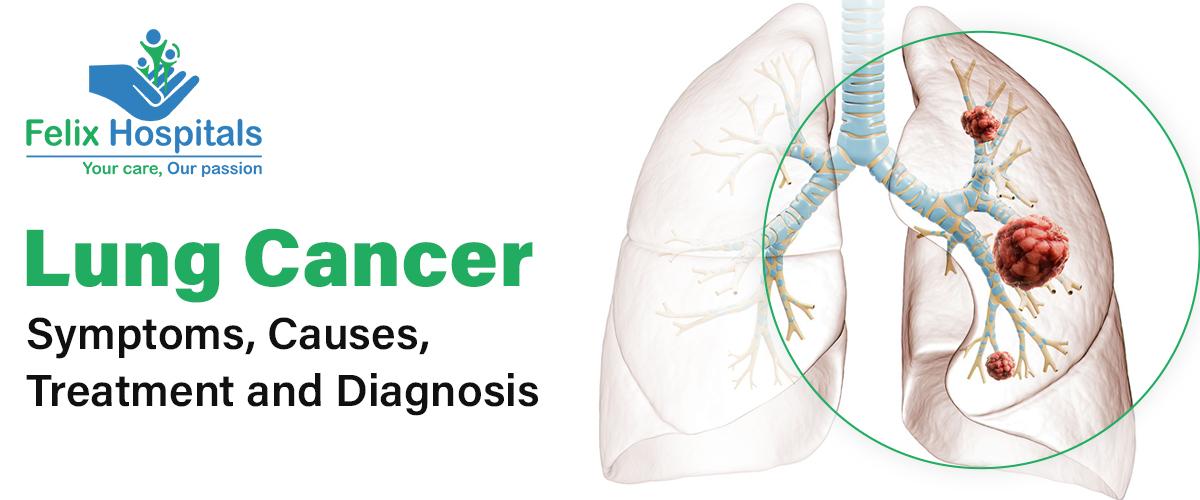 Lung Cancer - Symptoms, Causes, Treatment and Diagnosis