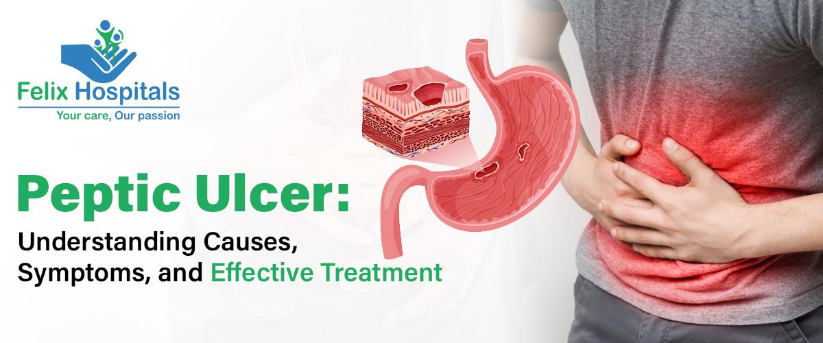 Peptic Ulcer: Causes, Symptoms, and Effective Treatment