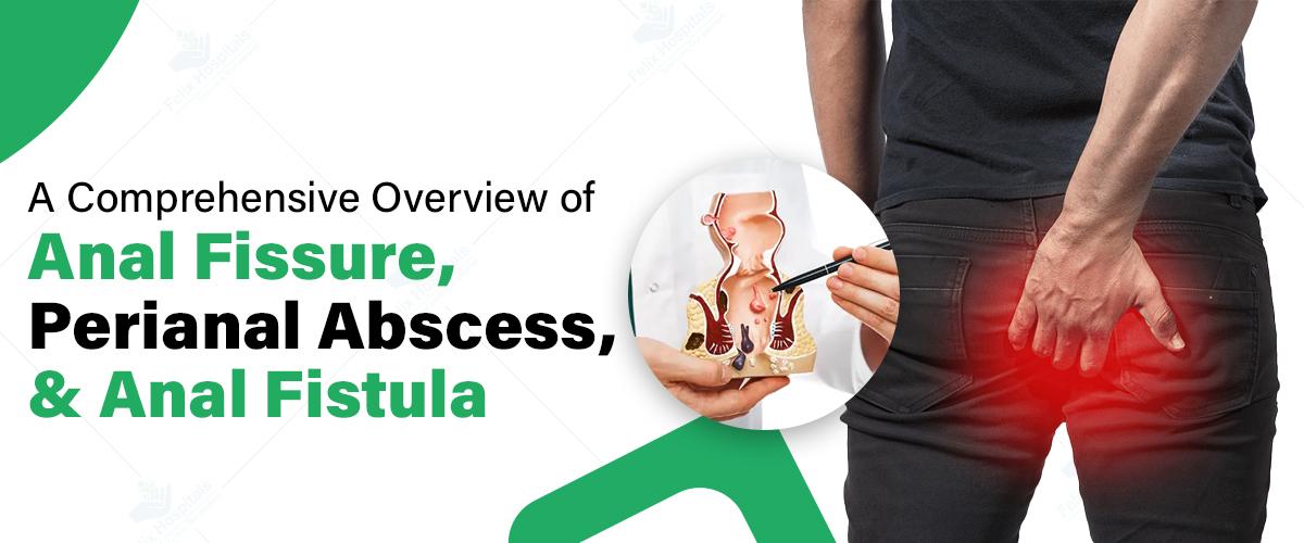 A Comprehensive Overview of Anal Fissure, Perianal Abscess, and Anal Fistula