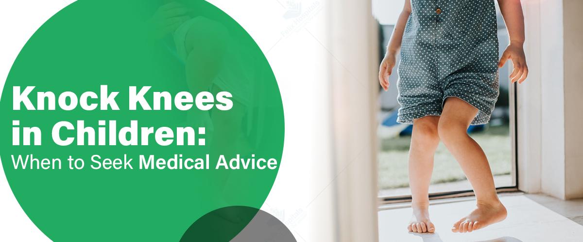 Knock Knees in Children: When to Seek Medical Advice