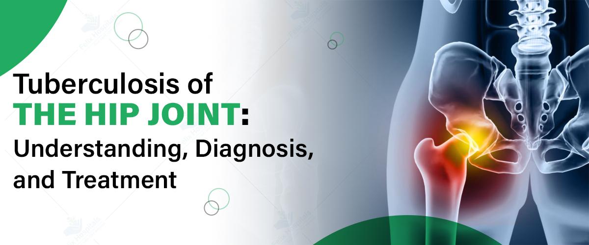 Tuberculosis of the Hip Joint: Understanding, Diagnosis, and Treatment