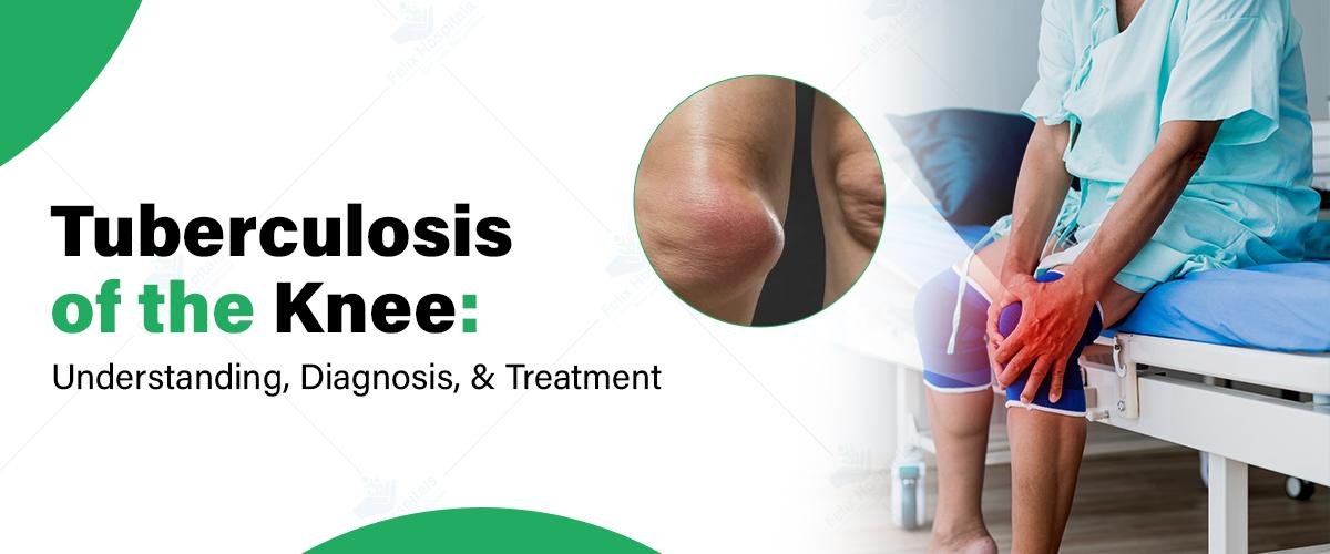 Tuberculosis of the Knee: Understanding, Diagnosis, and Treatment