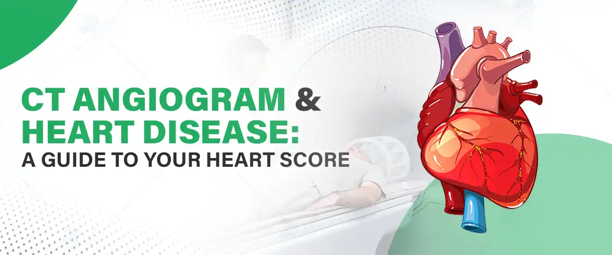 CT Angiogram & Heart Disease: A Guide to Your Heart Score