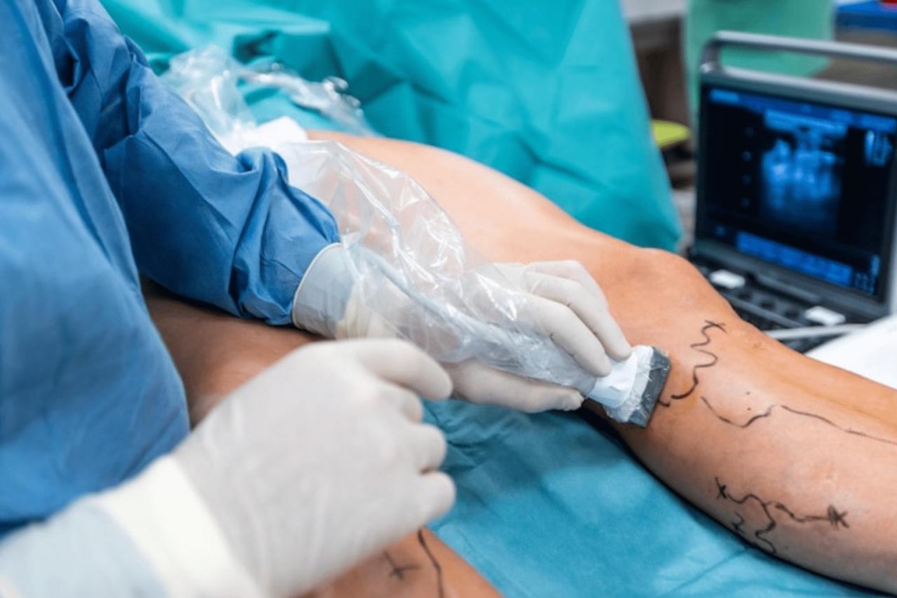 Vascular Surgery
