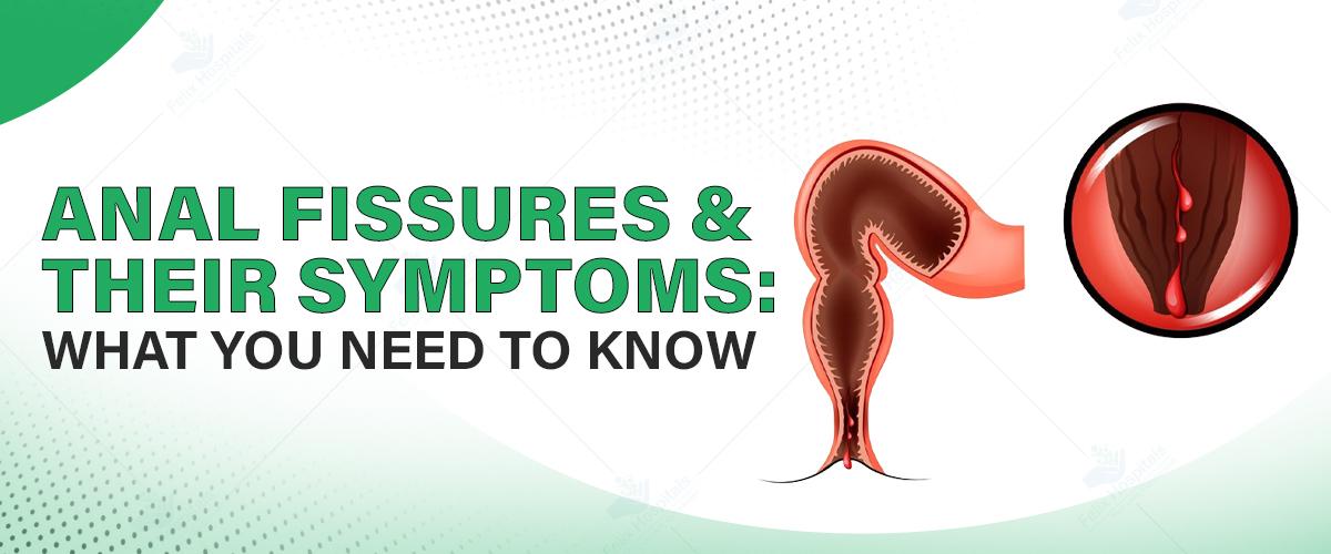 Anal Fissures and Their Symptoms: What You Need to Know