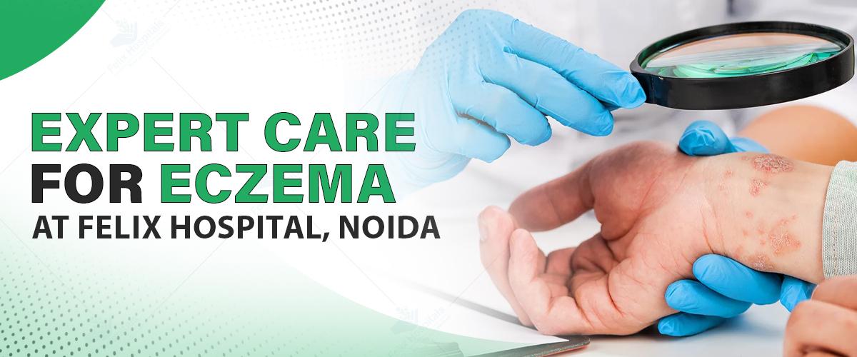 Expert Care for Eczema at Felix Hospital, Noida