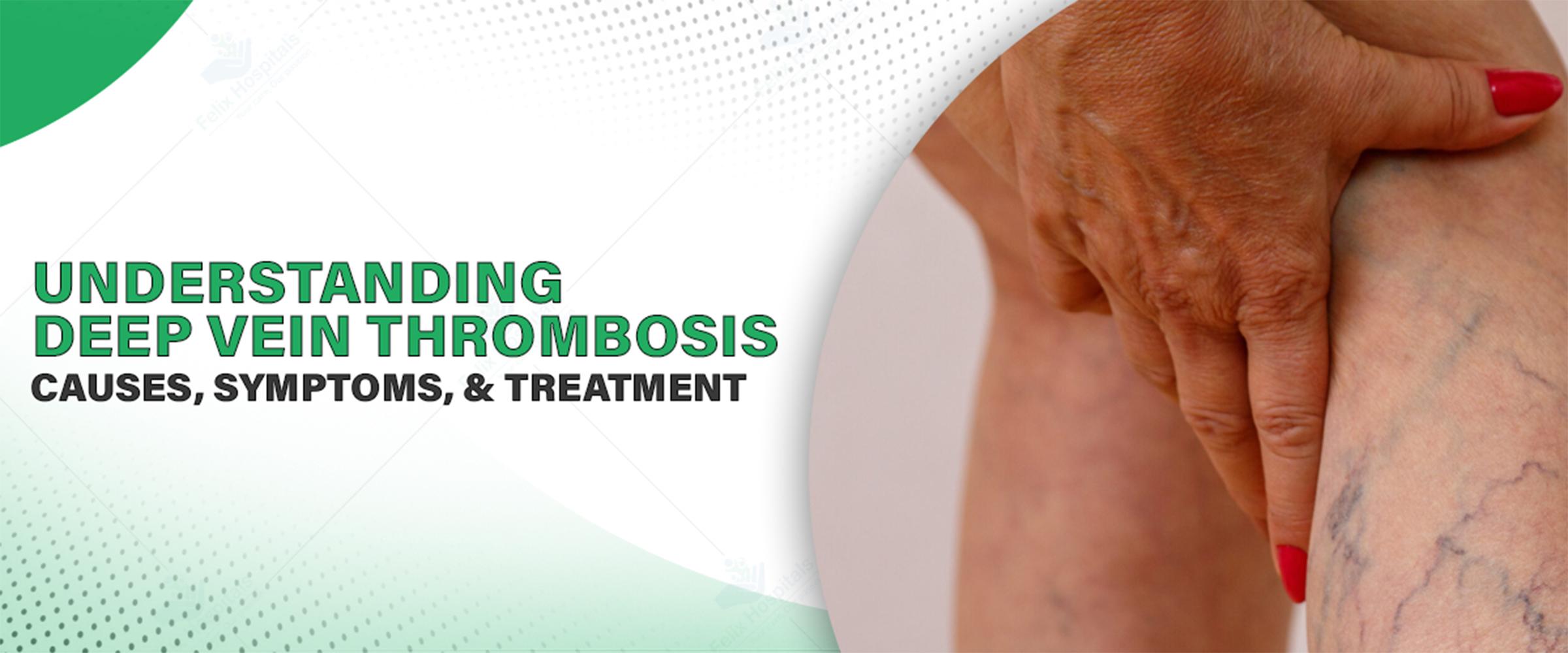Understanding Deep Vein Thrombosis: Causes, Symptoms, and Treatment
