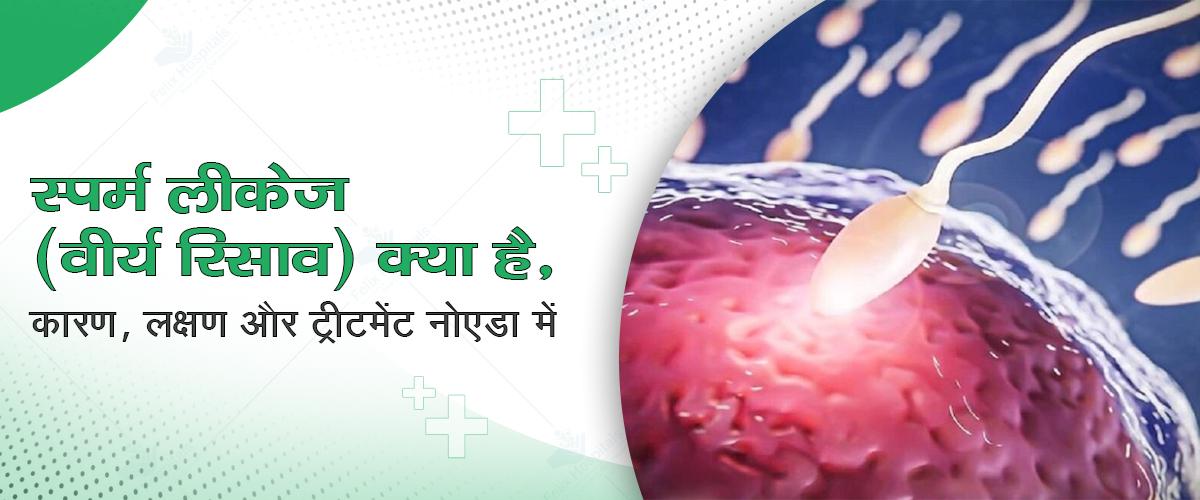 स्पर्म लीकेज (वीर्य रिसाव) क्या है, कारण, लक्षण और ट्रीटमेंट नोएडा में