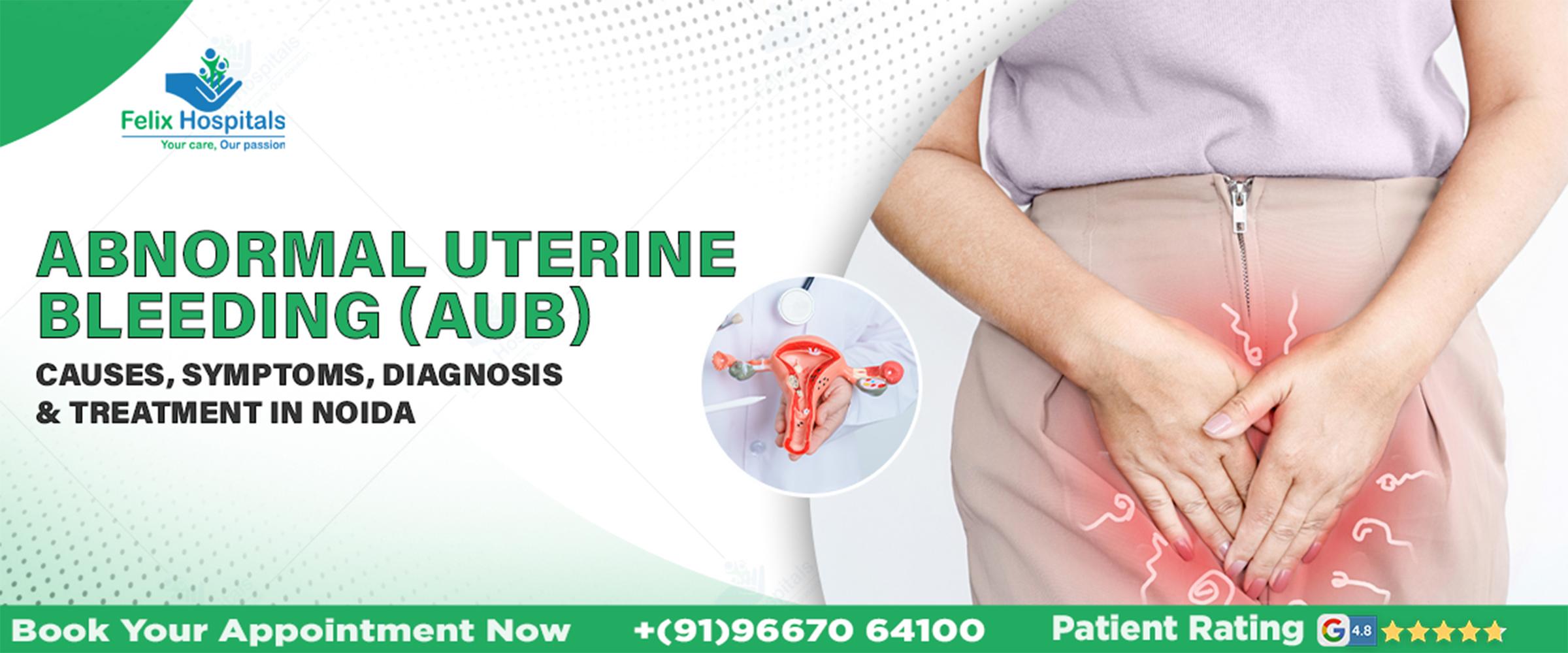 Abnormal Uterine Bleeding (AUB): Causes, Symptoms, Diagnosis & Treatment In Noida