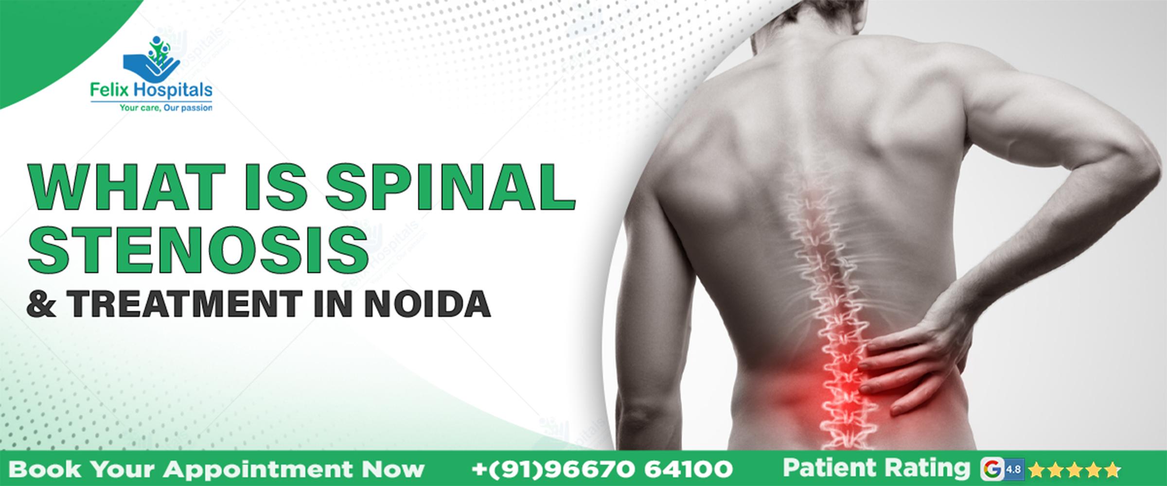 What is Spinal Stenosis and Treatment in Noida