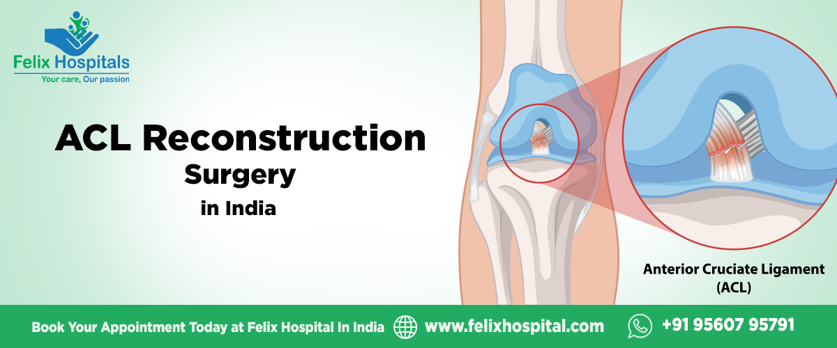 ACL Reconstruction Surgery in India