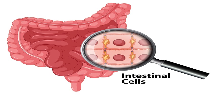 Large Intestine