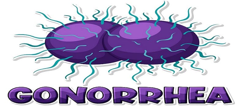 गोनोरिया (Gonorrhea): कारण, लक्षण और इलाज