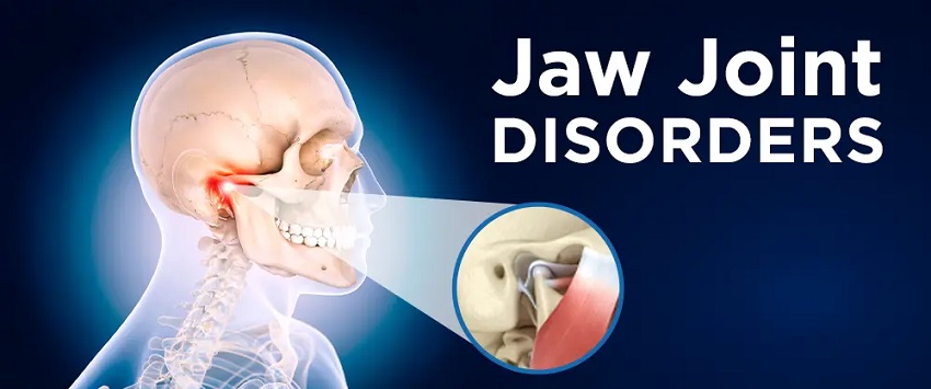 Jaw joint