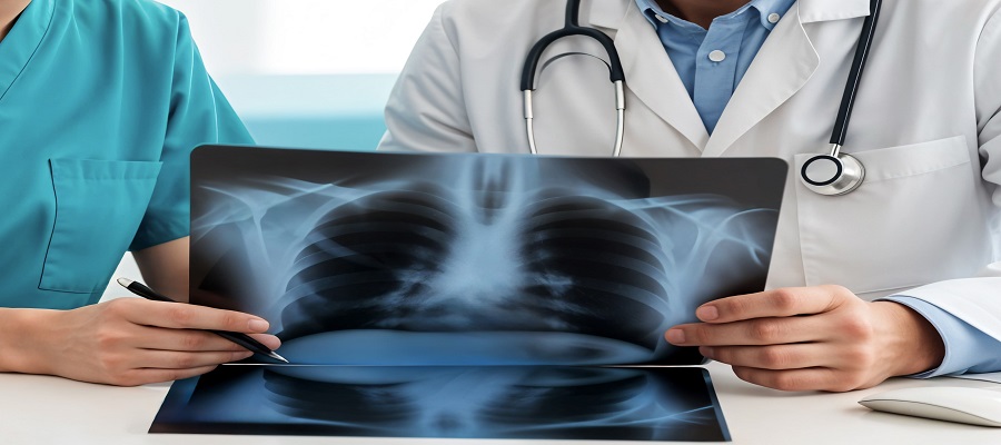 Lung Collapse