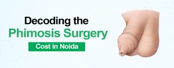 Decoding the Spider Veins Removal Cost in Noida