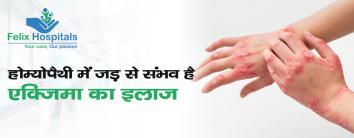 Eczema Treatment In Hindi