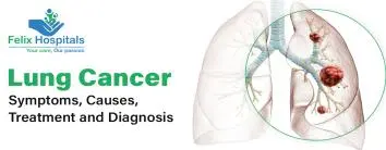 lung cancer symptoms
