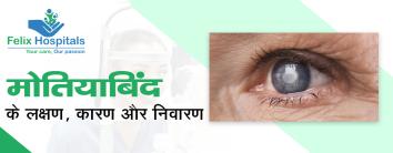 Cataract Surgery Treatment Meaning in Hindi