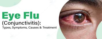 Eye Flu Treatment in Noida