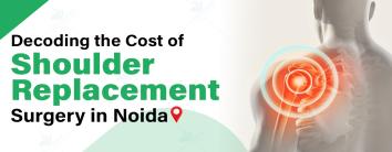 Decoding the Cost of Shoulder Replacement Surgery in Noida