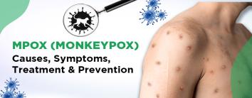 Best Hospital for Mpox Treatment in Noida