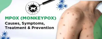 Best Hospital for Mpox Treatment in Noida