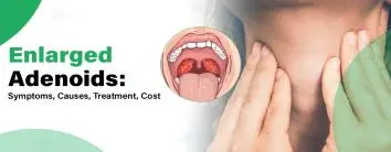 Best Enlarged adenoids treatment Hospital