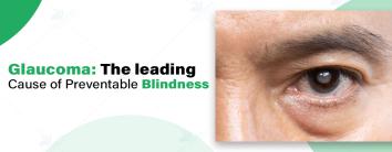 Best Glaucoma treatment noida