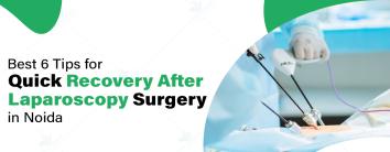 Best Laparoscopic Surgery Hospital in Noida