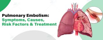 Best Pulmonology Hospital in Noida