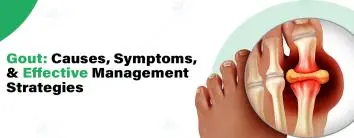 Gout treatment in noida