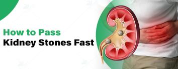 How to Pass Kidney Stones Fast