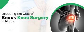 Cost of Knock Knee Surgery in Noida