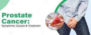 Prostate Cancer Treatment in Noida