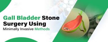 Best Gallbladder stone surgery hospital in Noida