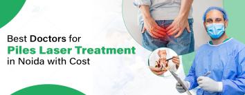 Piles Laser Treatment in Noida