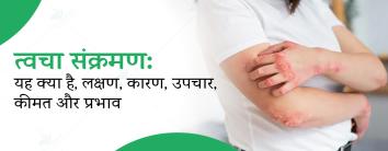 Best Hospital for skin infection treatment in noida