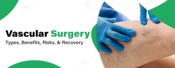 Best Vascular Surgery Hospital in Noida