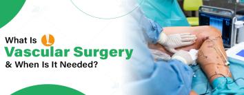 Vascular surgery Treatment Hospital