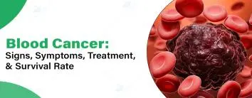 Blood Cancer in noida