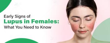 Early Signs of Lupus in Females