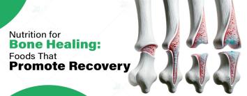 Nutrition for Bone Healing