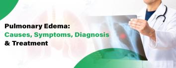 Best Pulmonary Edema Hospital in Noida 