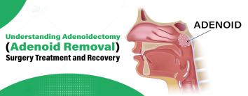 Best hospital for adenoid removal surgery