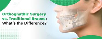 Orthognathic Surgery vs. Traditional Braces