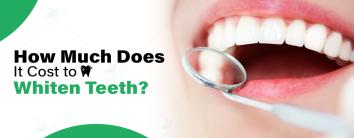 How Much Does It Cost to Whiten Teeth? 