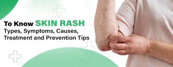 Skin rashes treatment hospital in Noida